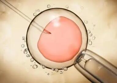 做泰国试管婴儿为什么要限制胚胎移植的数量