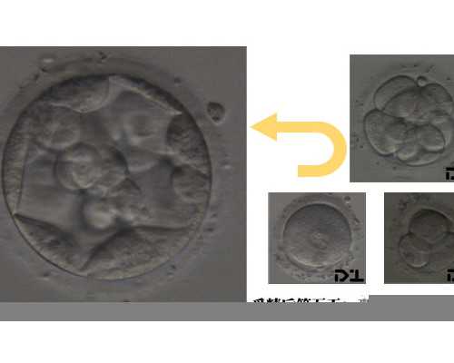 女人做了试管人就废了，还影响寿命？实为2026最大的谣言