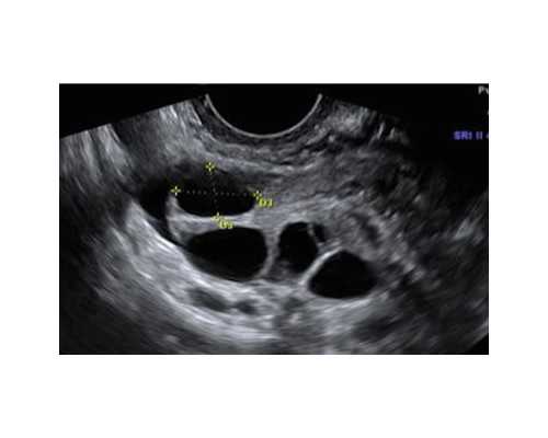 2026河南省三代试管婴儿医院大全，找对医生成功一半