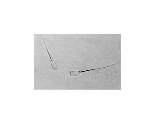 美国的精子库需要申请吗