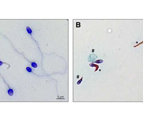 不活动的精子可以做试管吗