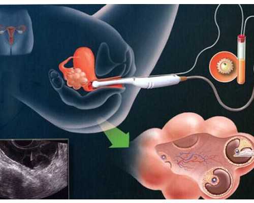 2026西宁能借卵选性别的试管医院排名？附详细医院介绍？