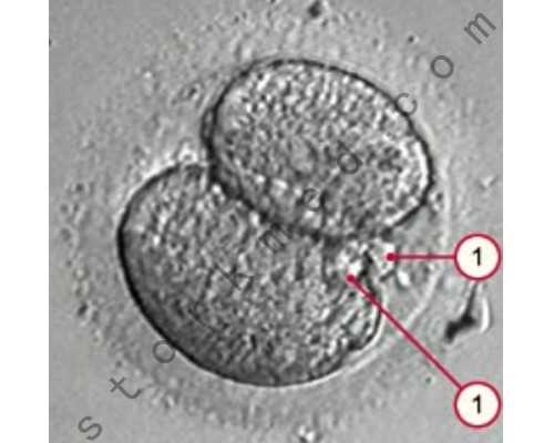别不信,马来西亚试管婴儿生儿子真靠谱!精子分离术轻松圆梦